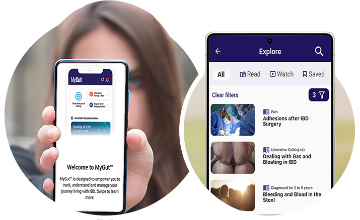 MyGut® displayed on a mobile device