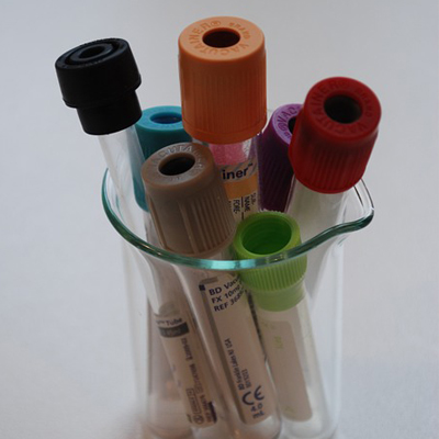 blood sample vials