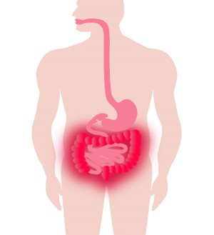 Digestive system showing inflammation in someone with ulcerative colitis