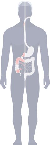 person with IBD illustration